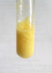 El color amarillo indica la presencia de aminoácidos con anillos aromáticos en su estructura